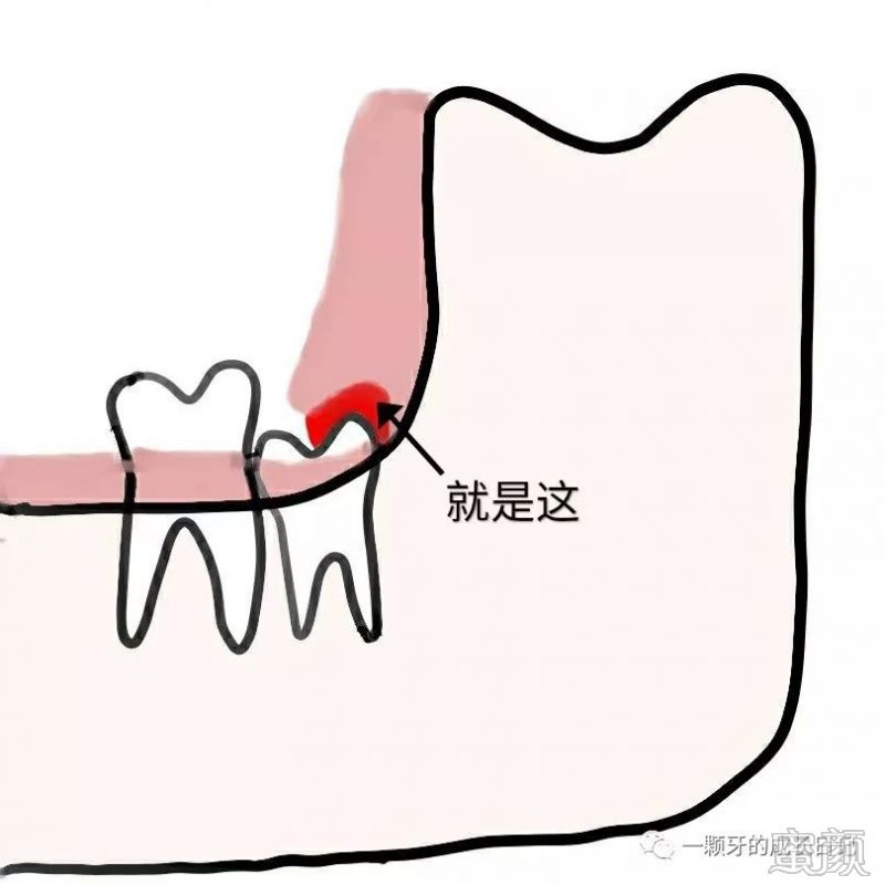 案例图片