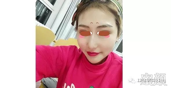 案例图片