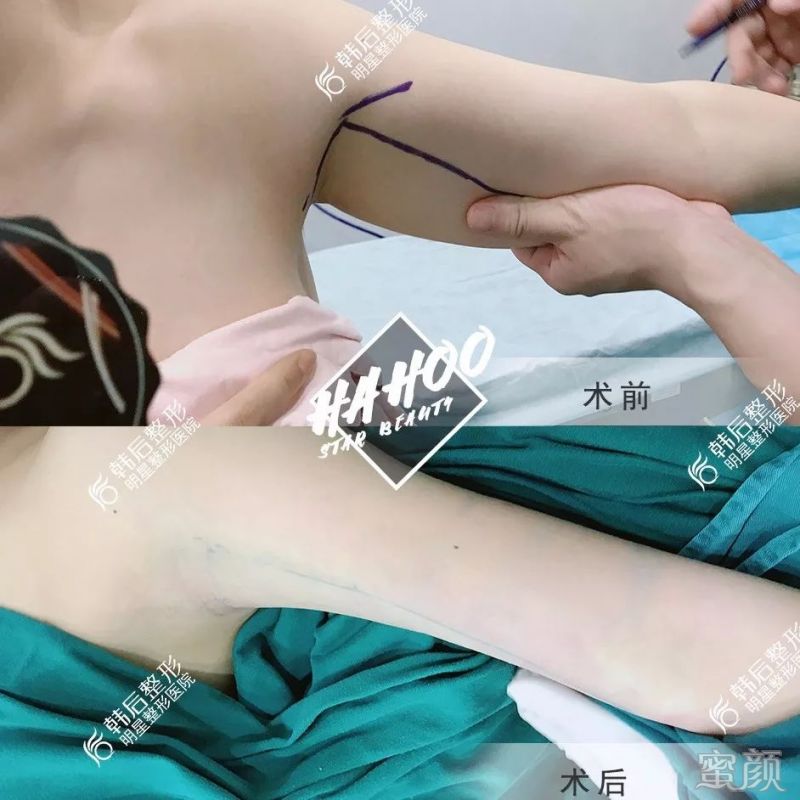案例图片