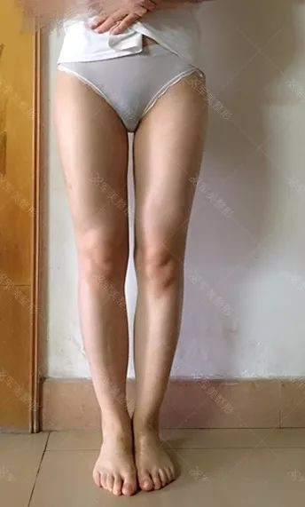 https://img.yiyiaimei.com/mnt/timg/200119/1403326294-6.jpg 案例图片