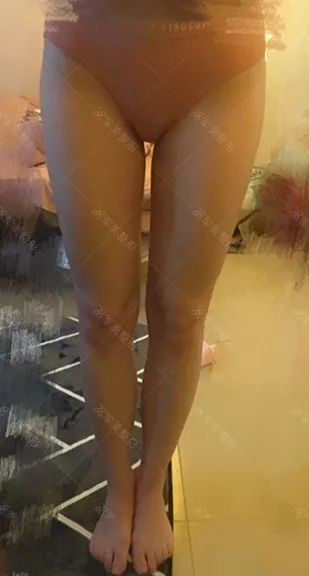 https://img.yiyiaimei.com/mnt/timg/200119/140332O13-5.jpg 案例图片