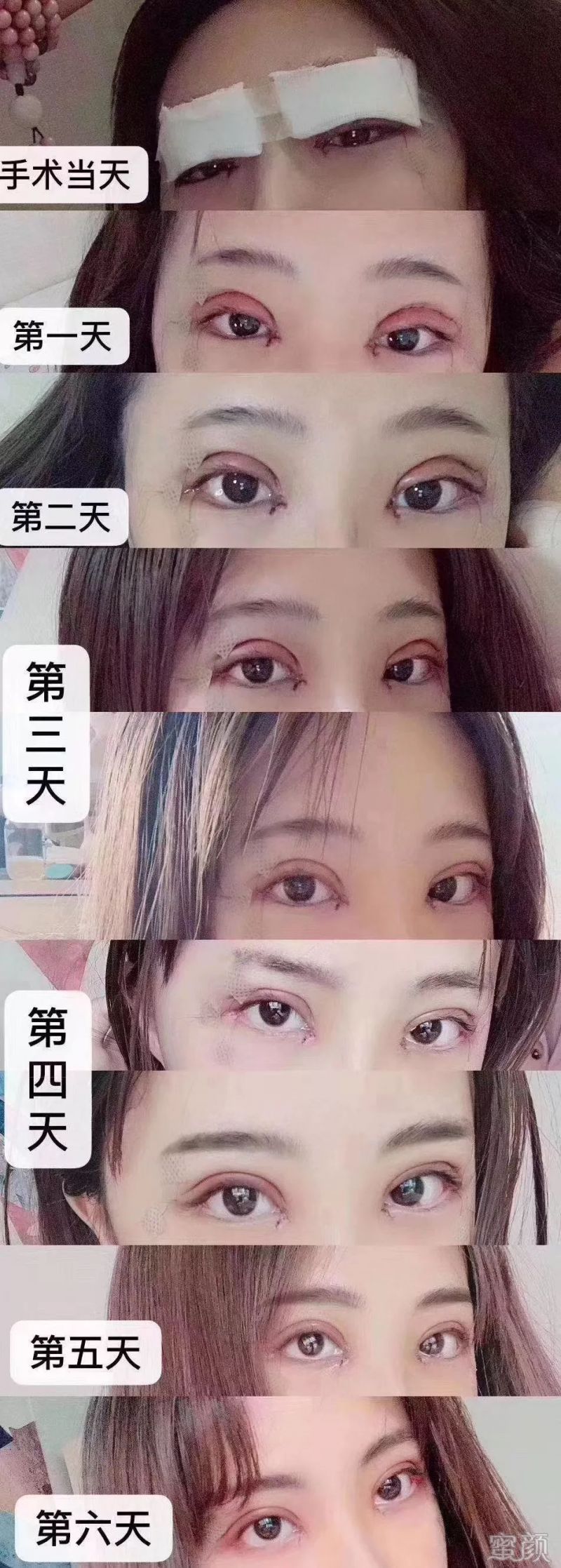 案例图片