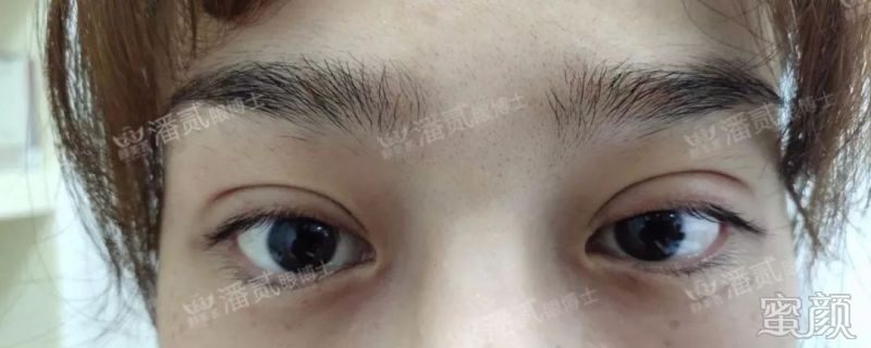 案例图片