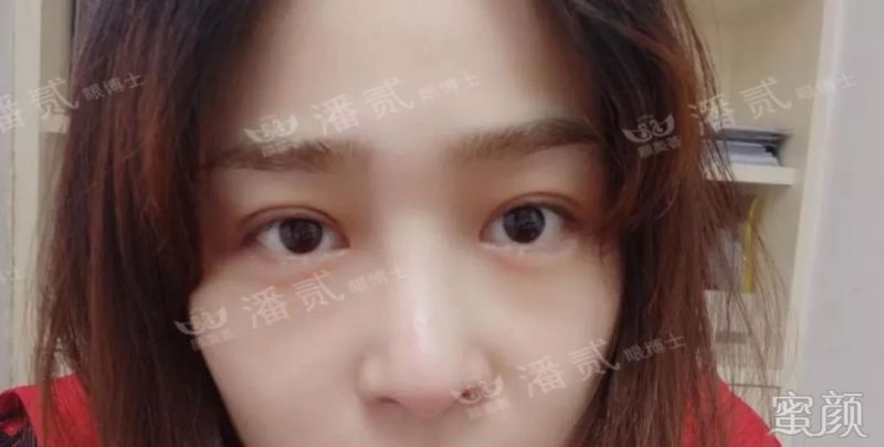 案例图片
