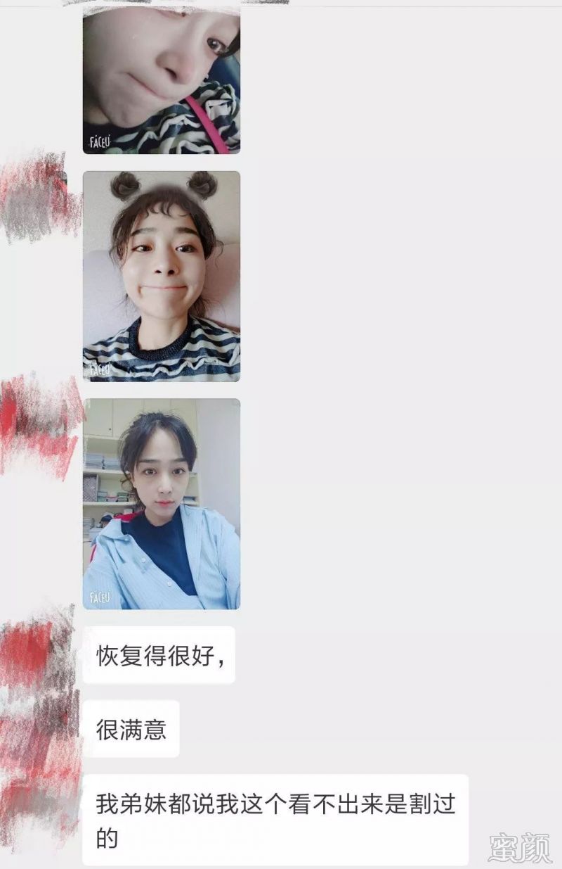 案例图片