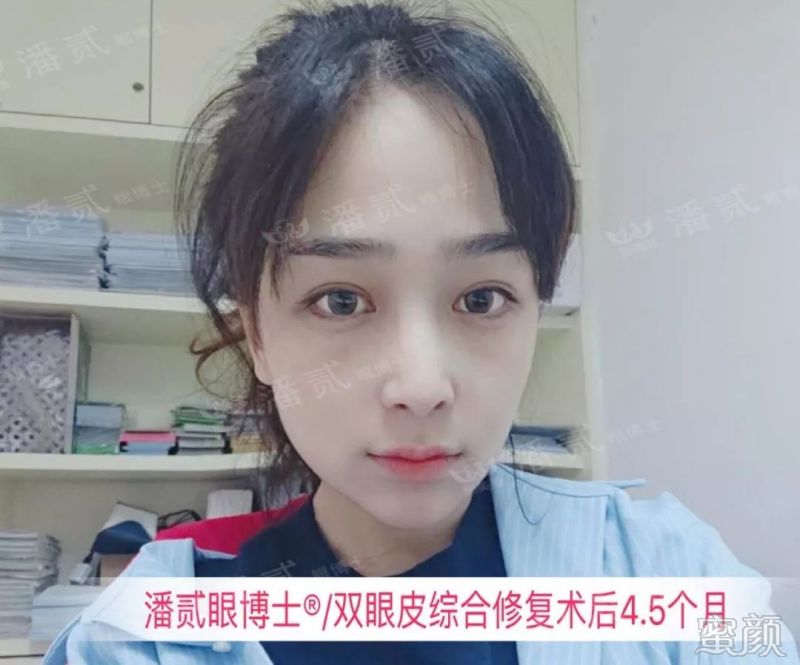 案例图片