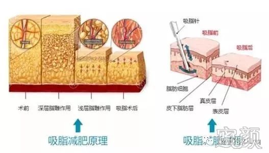 案例图片