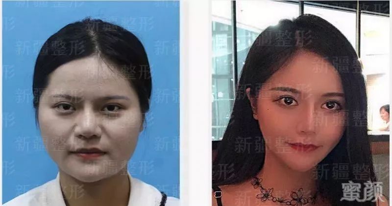 案例图片