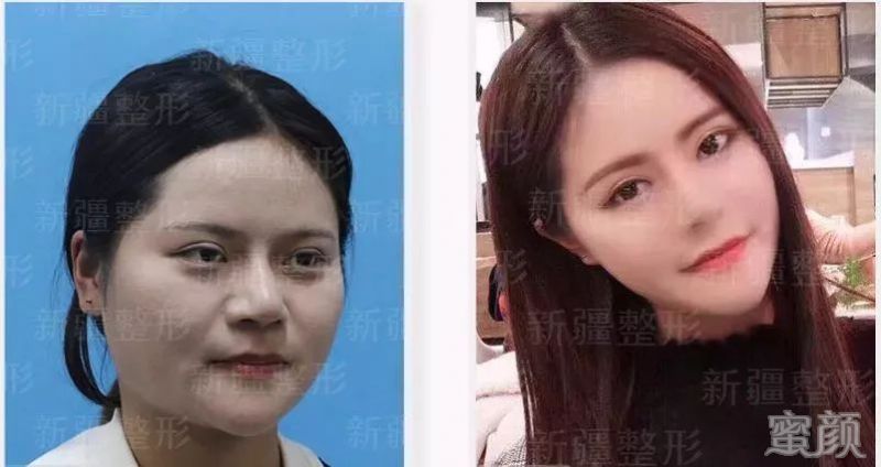 https://img.yiyiaimei.com/mnt/timg/200120/1221225D1-5.jpg 案例图片
