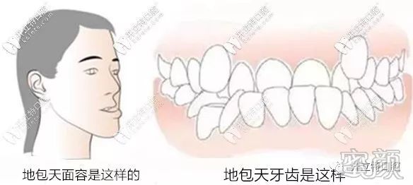 案例图片