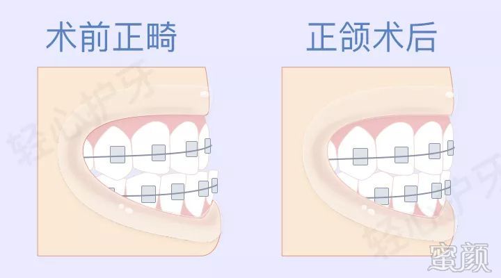 案例图片