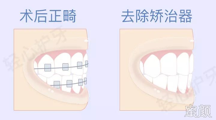 案例图片