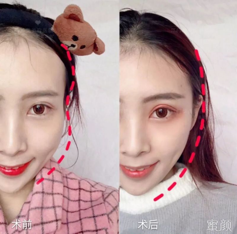 https://img.yiyiaimei.com/mnt/timg/200120/12551240F-3.jpg