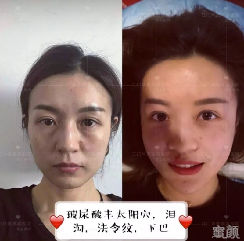 https://img.yiyiaimei.com/mnt/timg/200120/125513L02-4.jpg