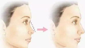 https://img.yiyiaimei.com/mnt/timg/200120/132204J44-6.jpg 案例图片