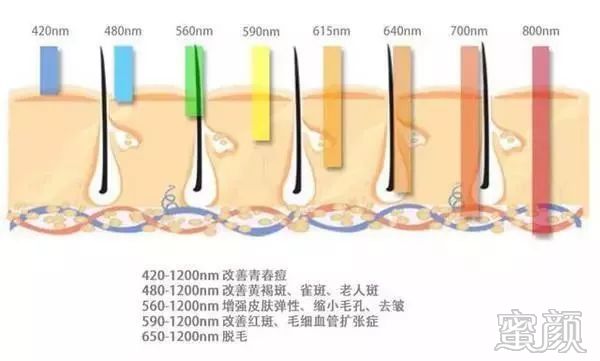 https://img.yiyiaimei.com/mnt/timg/200120/1339462009-4.jpg 案例图片