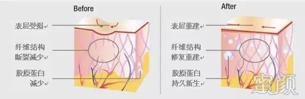 https://img.yiyiaimei.com/mnt/timg/200120/1339504311-6.jpg 案例图片