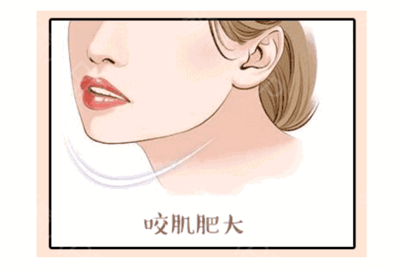 https://img.yiyiaimei.com/mnt/timg/200120/1339515N9-9.jpg 案例图片