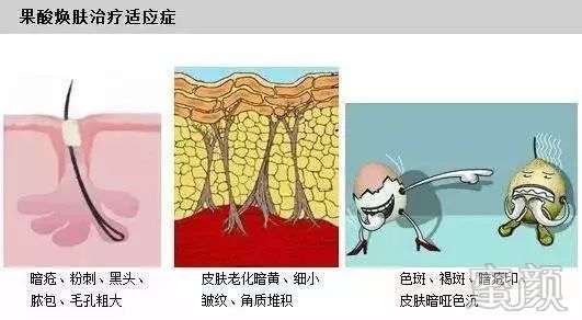 https://img.yiyiaimei.com/mnt/timg/200120/133959A33-12.jpg 案例图片