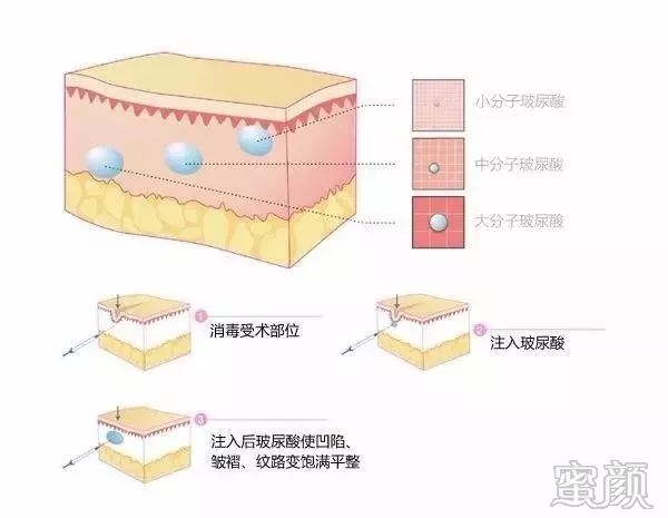 案例图片