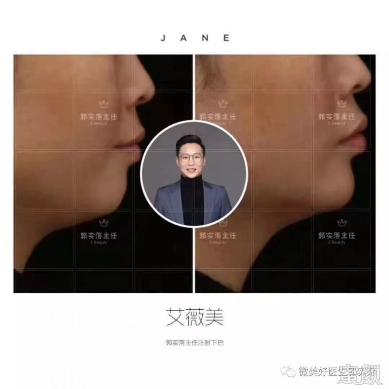 案例图片