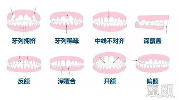 案例图片