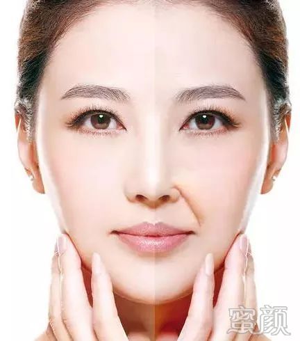 案例图片