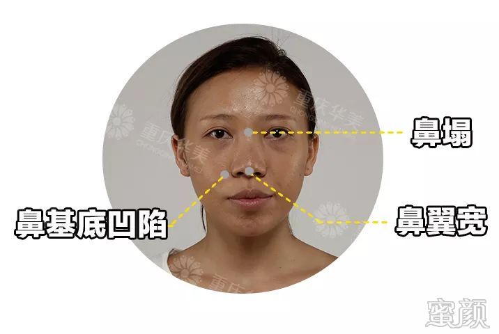 案例图片