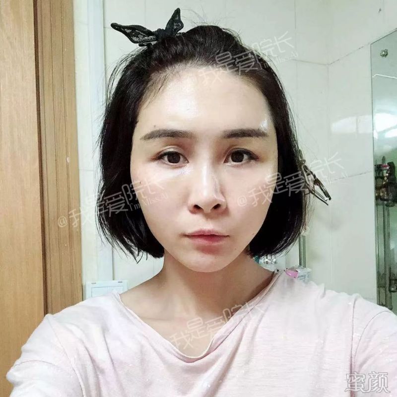 https://img.yiyiaimei.com/mnt/timg/200121/1225462a2-3.jpg