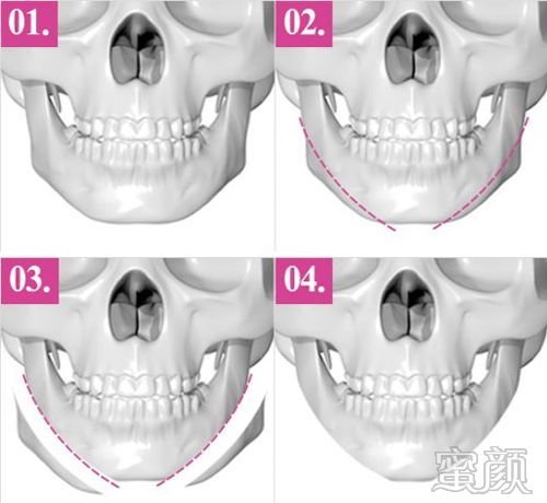 https://img.yiyiaimei.com/mnt/timg/200121/1244223B6-0.jpg