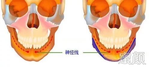 https://img.yiyiaimei.com/mnt/timg/200121/1244315341-7.jpg