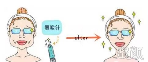https://img.yiyiaimei.com/mnt/timg/200121/132041J33-1.jpg