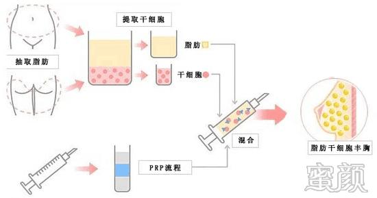 案例图片