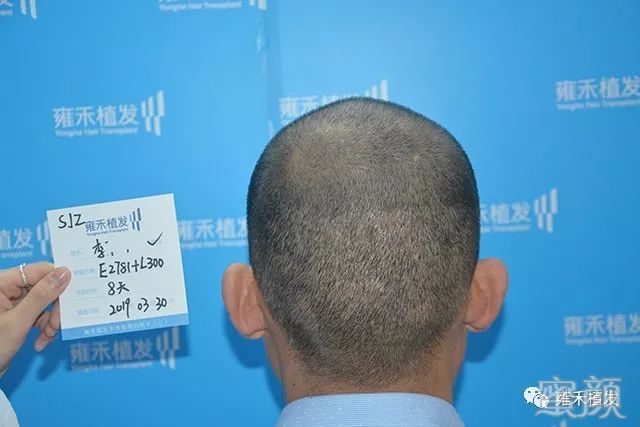 https://img.yiyiaimei.com/mnt/timg/200122/13002135W-10.jpg
