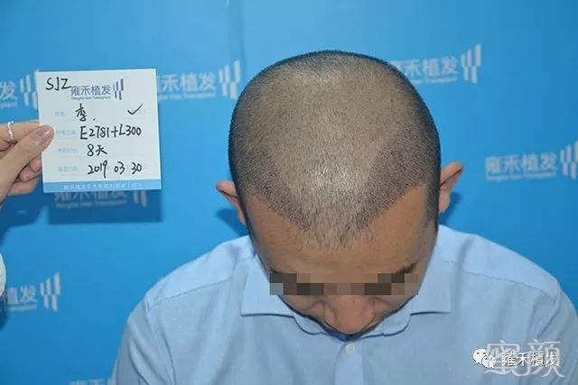 https://img.yiyiaimei.com/mnt/timg/200122/130021K59-9.jpg