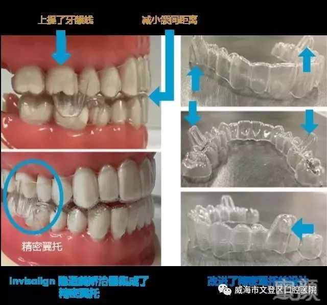 案例图片