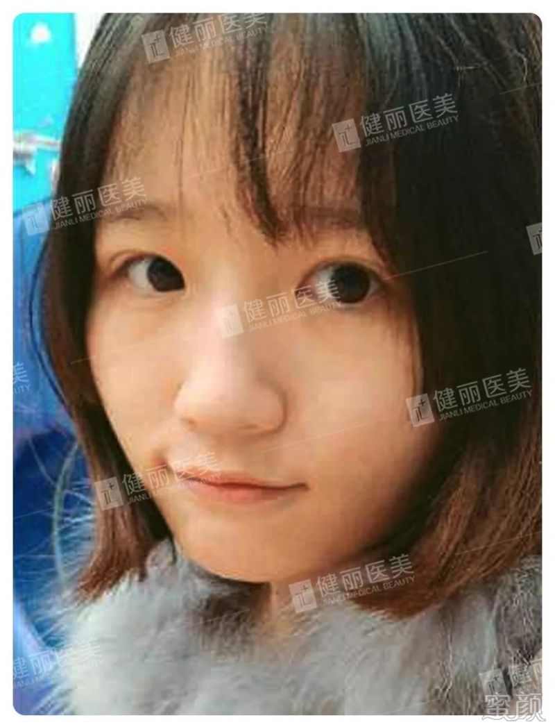 https://img.yiyiaimei.com/mnt/timg/200122/1304411334-3.jpg