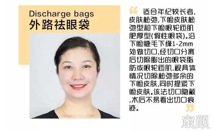 案例图片