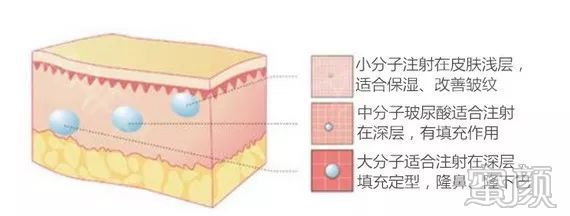 https://img.yiyiaimei.com/mnt/timg/200123/12315030C-3.jpg