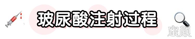 https://img.yiyiaimei.com/mnt/timg/200123/123151G19-5.jpg