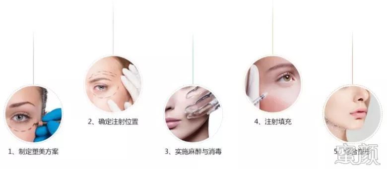 https://img.yiyiaimei.com/mnt/timg/200123/123152B07-6.jpg