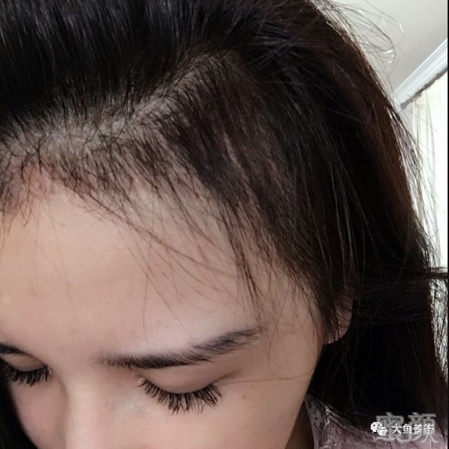 https://img.yiyiaimei.com/mnt/timg/200123/1310164303-3.jpg