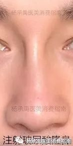 https://img.yiyiaimei.com/mnt/timg/200123/13160QY4-0.jpg