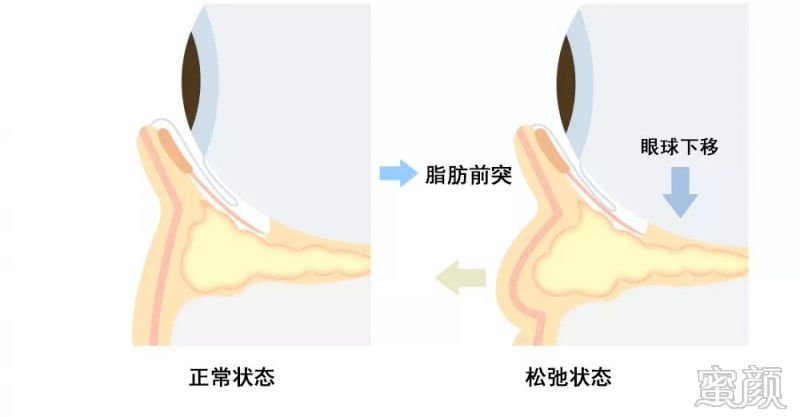 案例图片