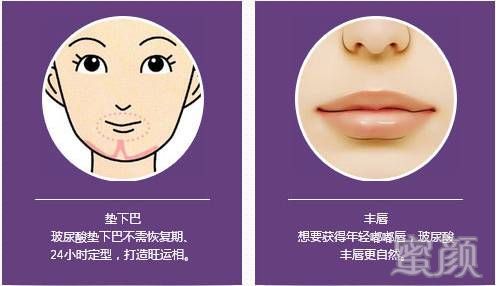 案例图片