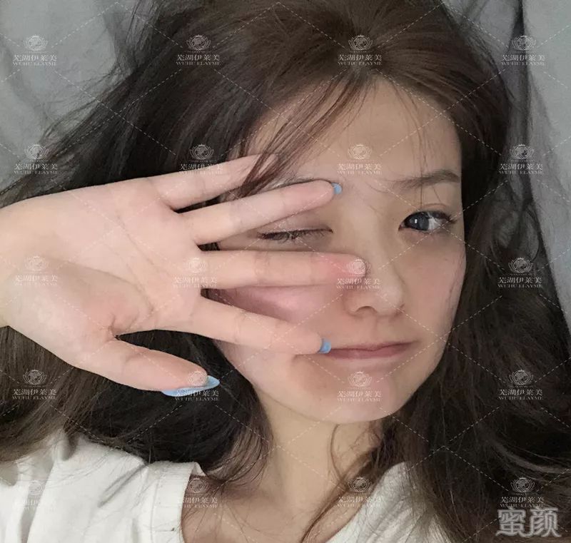 https://img.yiyiaimei.com/mnt/timg/200123/133JI505-1.jpg