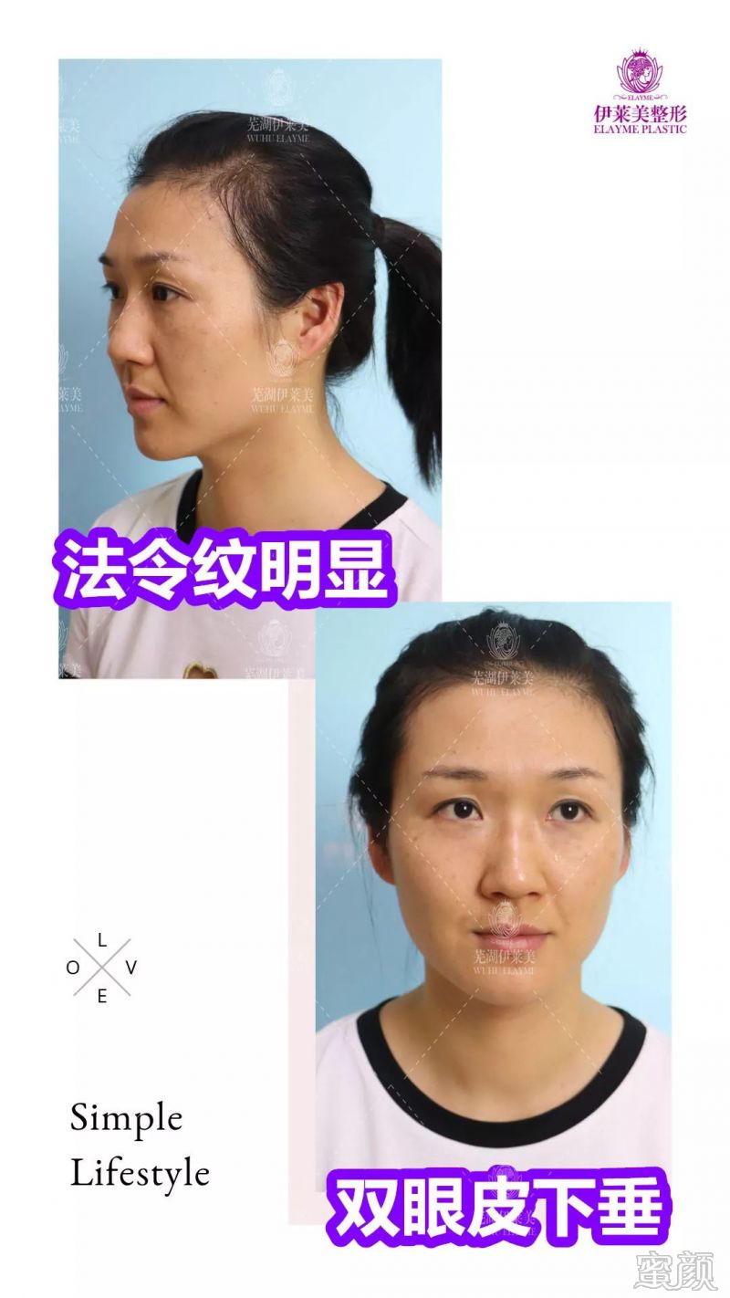 https://img.yiyiaimei.com/mnt/timg/200123/133K02D7-5.jpg