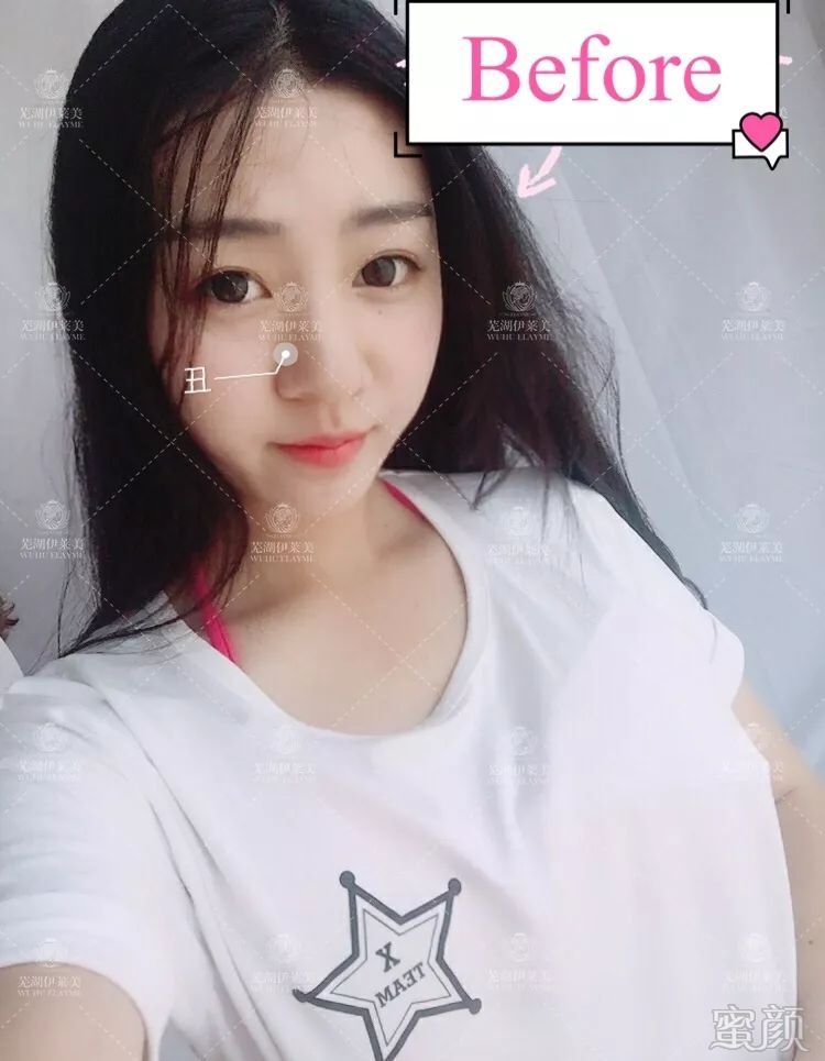 https://img.yiyiaimei.com/mnt/timg/200123/133K25J1-7.jpg