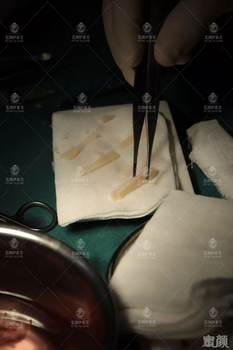 https://img.yiyiaimei.com/mnt/timg/200123/133K31622-9.jpg