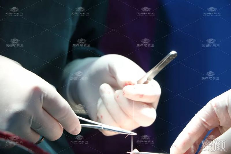 https://img.yiyiaimei.com/mnt/timg/200123/133K4O42-10.jpg